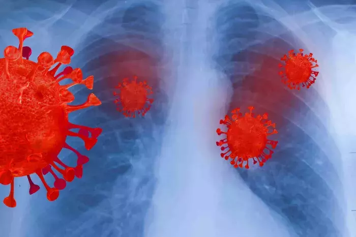 Lésions pulmonaires et vapotage